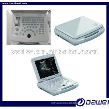 China Laptop Ultraschall-Scanner-System gynäkologischen Kit (DW500)